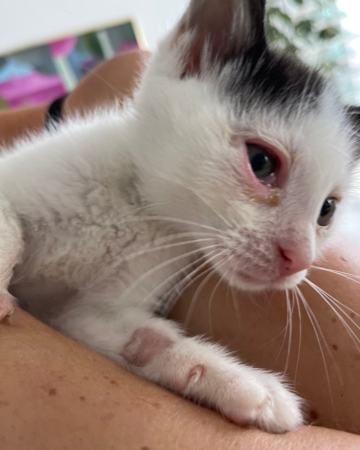 A black and white kitten held in a person's arm, with a red, watery eye